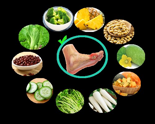Chế độ ăn uống dành cho người bị bệnh Gout (gút) 1