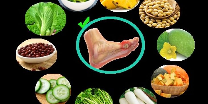Chế độ ăn uống dành cho người bị bệnh Gout (gút)