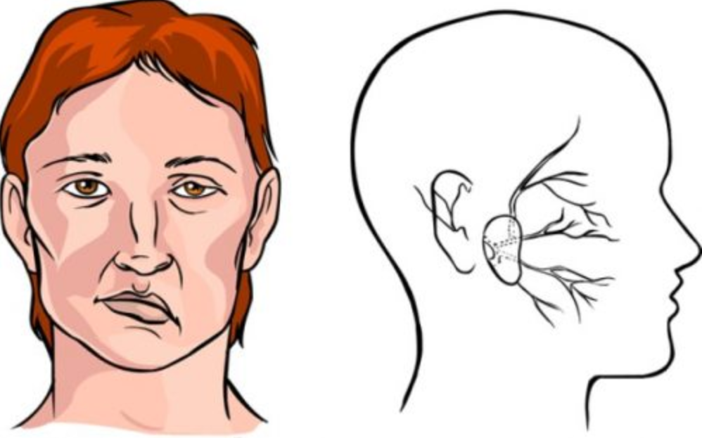 Bệnh zona thần kinh có nguy hiểm không? 3