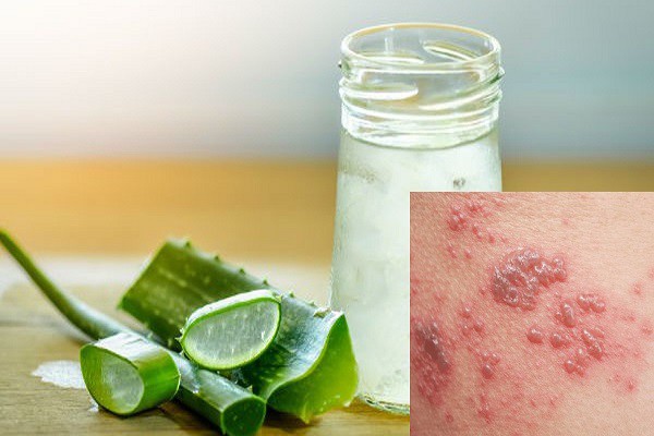 Phương pháp điều trị bệnh từ nguyên liệu thiên nhiên