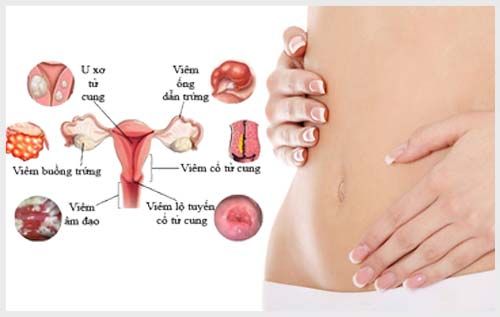 Mặc chung quần lót làm tăng nguy cơ gây bệnh phụ khoa
