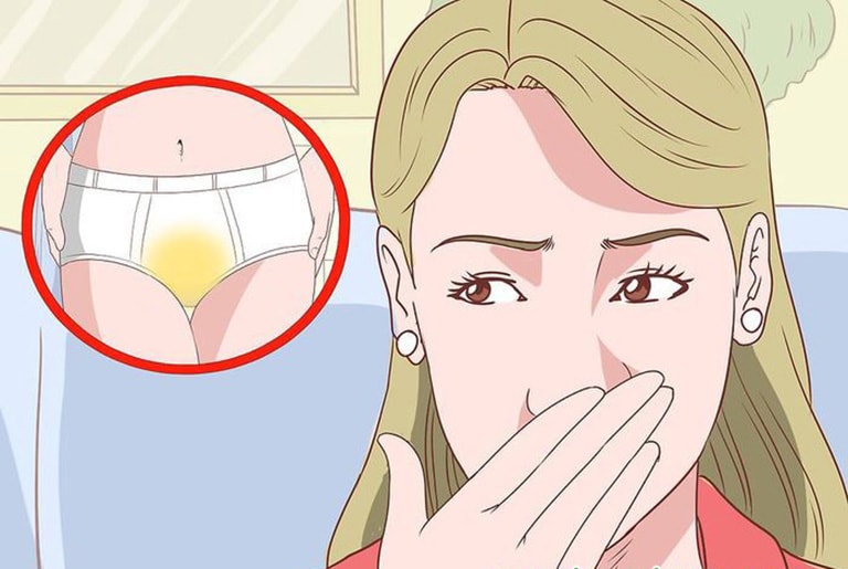 Đáy quần lót bị biến đổi màu sắc