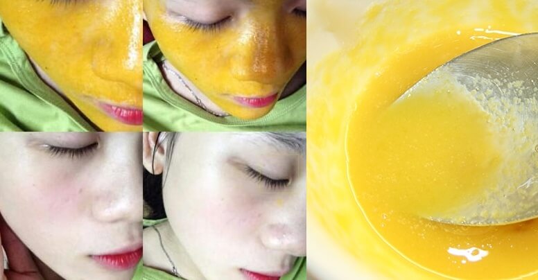 Làn da trắng và sạch mụn nhờ mặt nạ sữa chua kết hợp tinh bột nghệ