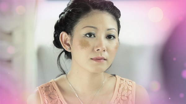 Cách trị nám da đơn giản với sữa chua và chuối 1