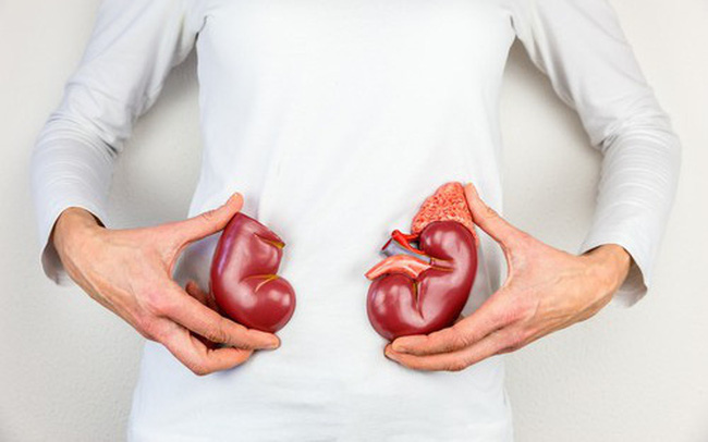 Bệnh nhân mắc bệnh thận phải cẩn trọng trong vấn đề ăn uống