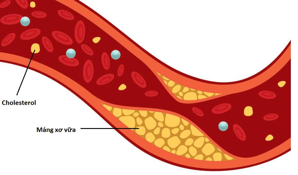 Ăn bơ giúp kiểm soát nồng độ cholesterol và đường trong máu