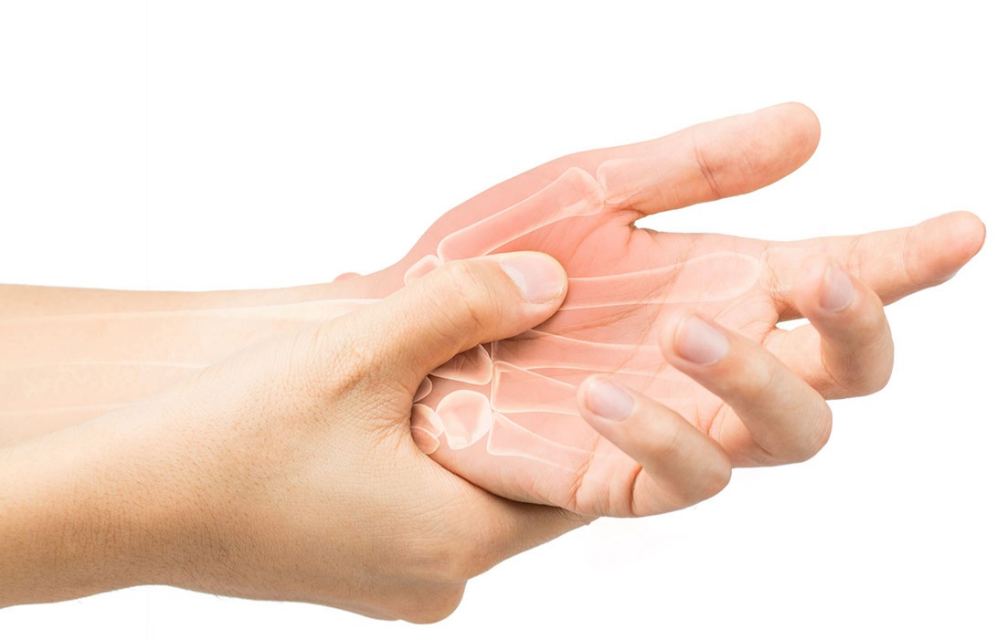 Hỗ trợ làm giảm triệu chứng viêm khớp dạng thấp