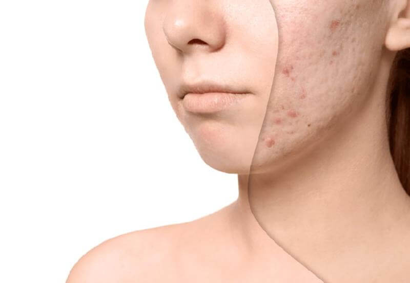 Giúp làm sáng da và mờ sẹo