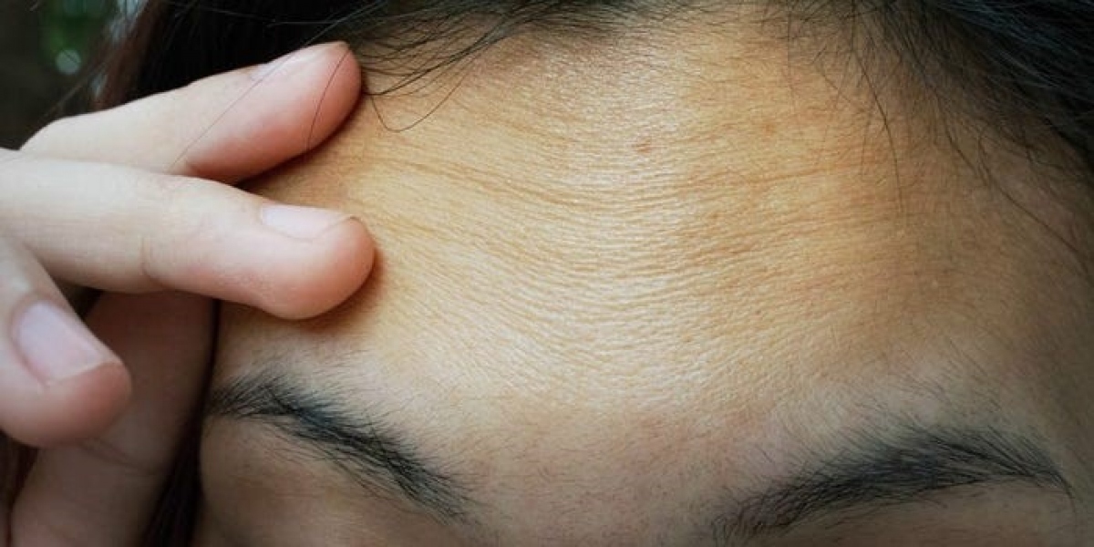 Ngăn ngừa và cải thiện các vết nhăn
