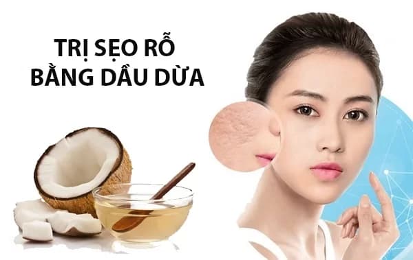 Mặt nạ nghệ dầu dừa giúp điều trị sẹo